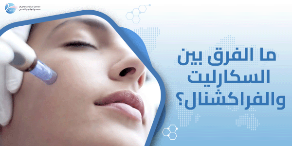 ما الفرق بين السكارليت والفراكشنال؟